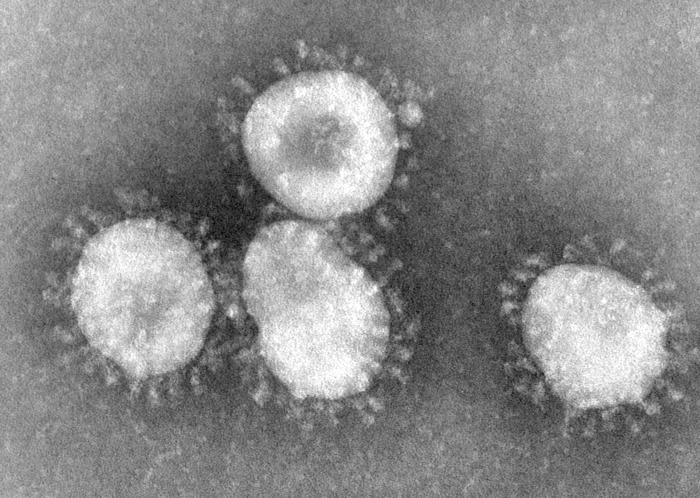 FIP felin infektiøs peritonitis coronavirus